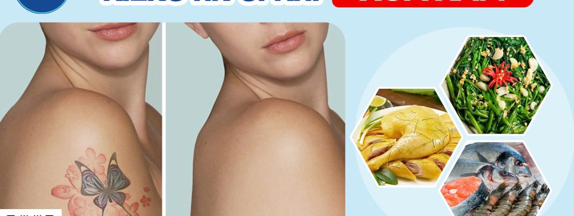 Kiêng ăn gì khi xóa xăm