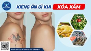 Kiêng ăn gì khi xóa xăm